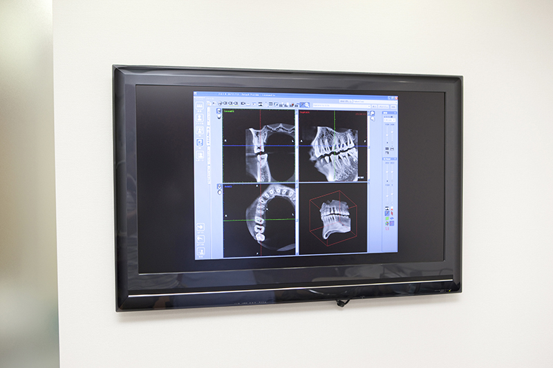 科用CT、デジタルレントゲン