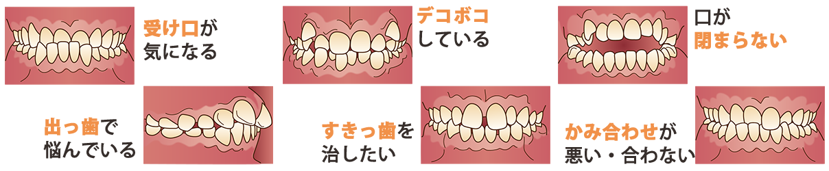 どのような歯並びでお悩みですか