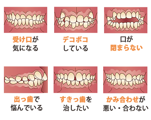 どのような歯並びでお悩みですか